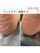 ピーアンドオー(P&O)/