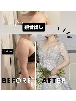 ラトナ(Ratna)/【結果写真】6回ブライダル痩身