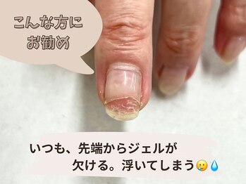 自爪育成/補修系美容液(+500円)