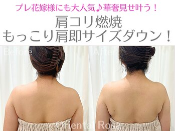 オリエンタルローザ 表参道(Oriental Rosa)/大人気★肩コリ燃焼サイズダウン