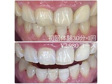 ホワイトニングルーム 横浜店(Whitening Room)/セルフホワイトニング/横浜
