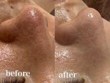 フェイシャルサロン アリイ(ALII)の雰囲気（当店人気No.１の毛穴美人で毛穴に自信をつけて、肌が輝く！）