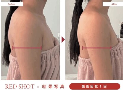 ニュイブラーシュ(nuit blanche)の写真