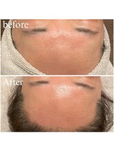 ビュウナ 銀座(BEAUNA)/シルクブライト