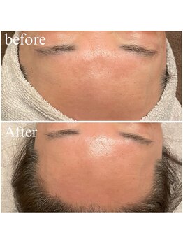 ビュウナ 銀座(BEAUNA)/シルクブライト