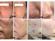 ジェイジェニークサロン グラン ギンザ(JJENYC SALON GRAND GINZA)の写真