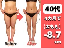 マルデビジュ 西宮(Mar de Bijou)の雰囲気（隠す脚から魅せる脚へ。太もも・大転子悩み40代からの美脚専門◎）