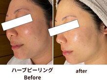 サロンソワ(salon Soi.)の雰囲気（剥離なしハーブピーリング/毛穴/くすみ/ニキビケア！一度で実感）