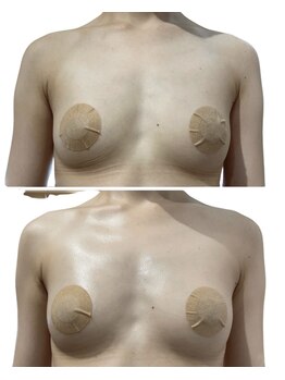 痩せラボ/気になるところにサイズアップ