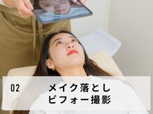 スマユー 新宿店(SMAU)/眉毛施術の流れ[SMAU新宿店]