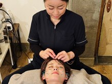 ボディーワークス 新町(BODY WORKS)/頭にも針を打ちます