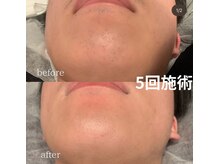 モア男子(MORE男子)/毎朝が楽に