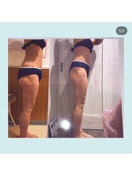 アンリール 苫小牧店(ANRIRE)/ボディー施術のお客様です