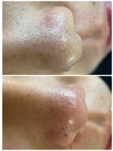 土曜日のクジラ 黒崎店/眉毛/メンズ眉毛/アイブロウ