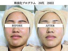 サンビ(SANBI)/赤みもくすみも無いお肌へ