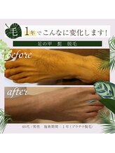 ラフラフ(Laf Laf)/足の指、甲