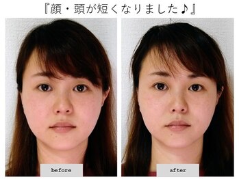 エピファニー(Epiphany)/30代　20代より顔が大きく？！