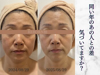 リボーン 柏(REBORN)/肌の透明感を呼び覚ます再生美容