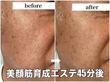 リエル(RIEL)/小顔矯正×美顔筋育成エステ