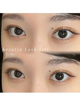 エクレ(Ecle)/まつパ◎ケラチンラッシュリフト