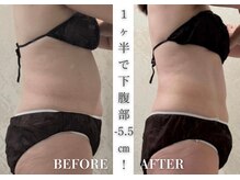 リアレント 高槻店(Lialent)/インディバ60分×6回【60代】