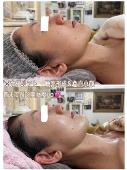 アルページュ(Arpege)/立体メリハリ小顔♪色白ベビー顔