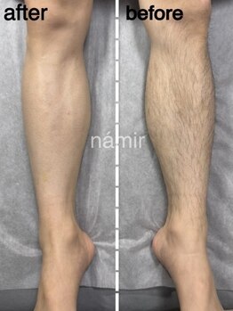 脱毛サロンnamir札幌店【ブラジリアンワックス/美容脱毛/眉毛】~メンズ/レディース~の写真/【―10代~60代の"メンズ脱毛は当たり前"時代!―】ブラジリアンワックスで「剛毛・太毛・白髪etc.」解決◎