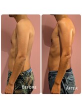 ククナ 上越店(KUKUNA)/30代男性（姿勢矯正３回）