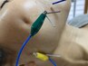 学割U24・【電気刺激美容鍼】￥7700→￥4000夏休みお試し60分。小顔体験◎