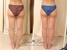 プライベートサロン タンタン(tantan)の雰囲気(頑固な身体も根本から改善して理想のボディラインへ)