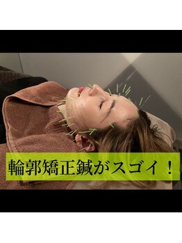 ルディア 堂島店(ledia)/オリジナルがスゴイ 大阪美容鍼