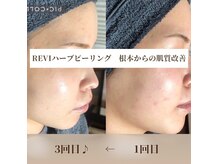 クレイエ(KREIE)の雰囲気（本気の肌質改善に陶肌トリートメント☆）