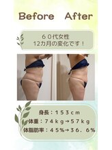 リシャイン(Reshine)/ダイエットＢＡ