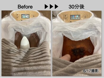 エルプラス(L+)/フッドデトックス　4