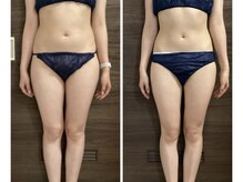 アール シュシュ(R.chouchou)/20代モデル様