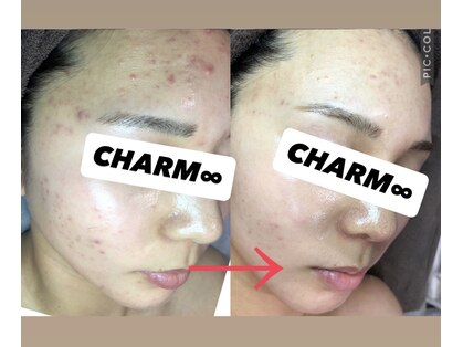 チャーム(CHARM∞)の写真