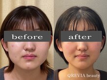 クレヴィアビューティー(QREVIA beauty)
