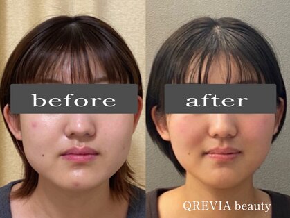 クレヴィアビューティー(QREVIA beauty)の写真