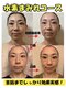 ヨサパーク ア モード ミオ 柴又店(YOSA PARK A modo mio)の写真/気になる顎のたるみも改善！むくみすっきり、お肌を内側から整えながら、輪郭美人に☆