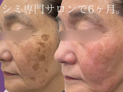 ハウオリ(HAUOLI)の写真