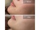 素肌研究所BSラボの写真
