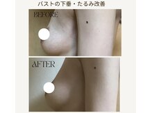 アップオー 小倉店(up・O)の雰囲気（産後バストのたるみ、シワ悩みにオススメ！ハリのあるバストへ！）