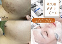 ナチュウル(Natulu)