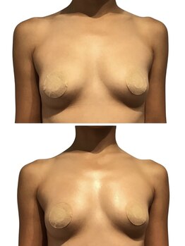 痩せラボ/トップに入れて綺麗な形へ