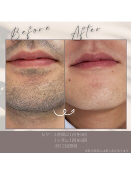 ヘブンビューティー(Heaven Beauty)/