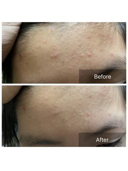 リノリー(rinory)/VOSサロンケア