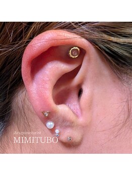 加島鍼灸接骨院/耳つぼジュエリー