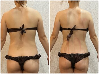 美容整体 ウェリナ 蟹江院/小顔矯正/骨盤矯正/美脚サロン 