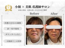 ルミア(LUMIA)の雰囲気(本気の美容!衝撃のBefore Afterでリピーター続出)