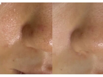 エムスリー(m3)の写真